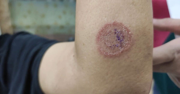 Những căn bệnh nguy hiểm bạn có thể lây từ thú cưng