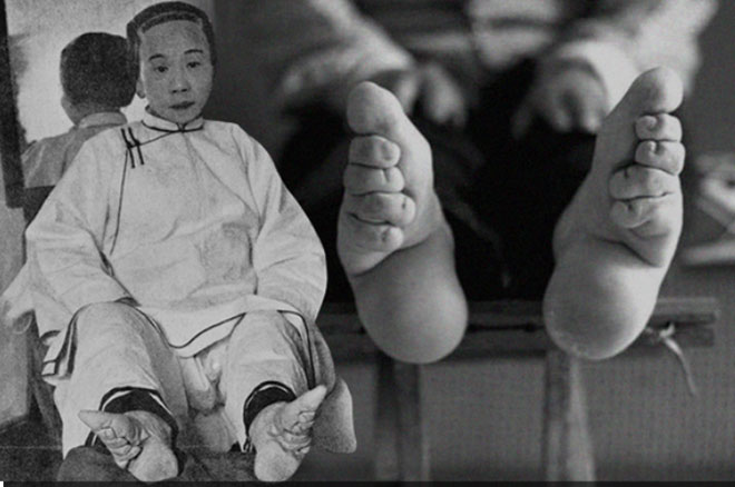 Người phụ nữ phong kiến Trung Hoa xưa cho rằng bó chân sẽ mang lại gót sen 3 tấc xinh đẹp.