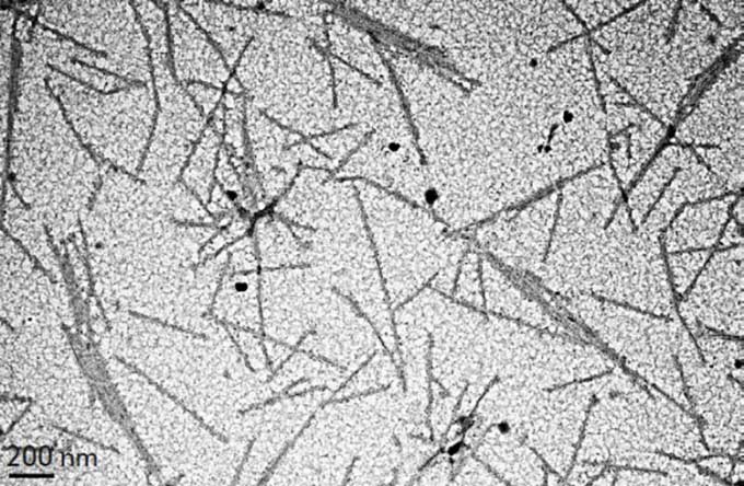 Virus đầu tiên được giới khoa học phát hiện là gì?