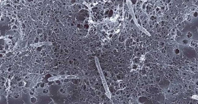 Một trong những loài cô đơn nhất trên Trái Đất, sống ở 2.800m dưới lòng đất và tồn tại nhờ năng lượng phóng xạ