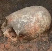 Các hộp sọ khai quật ở Thổ Nhĩ Kỳ có dấu vết "phẫu thuật sọ não" 3.200 năm trước