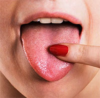 Nguyên nhân gây ra vị chua trong miệng là gì?