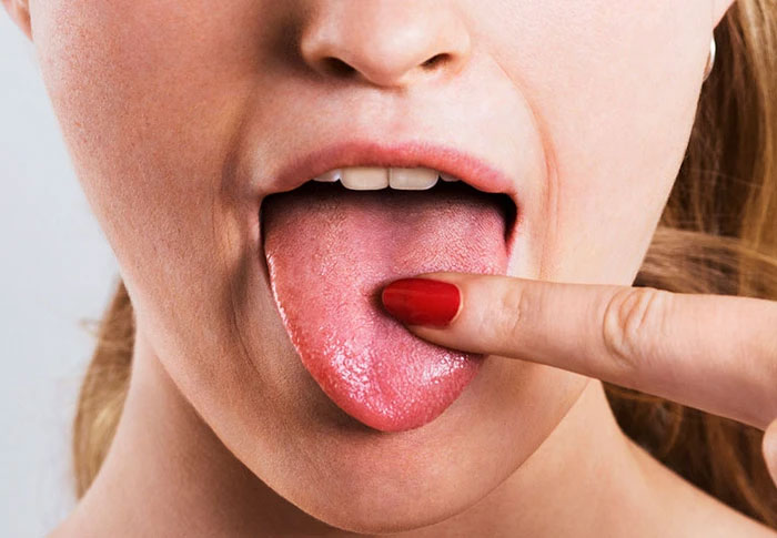 Nguyên nhân gây ra vị chua trong miệng?