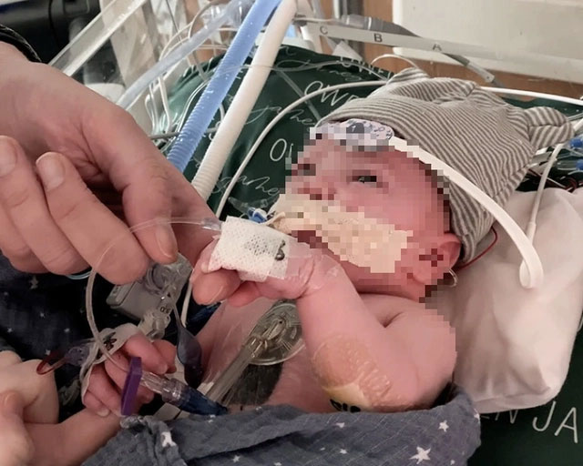 Em bé đầu tiên thế giới sống khỏe nhờ ghép một phần trái tim