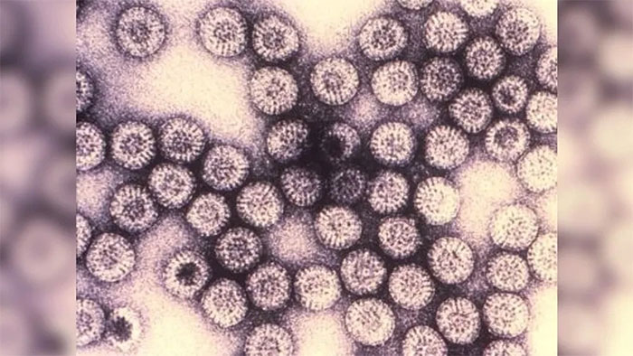 Danh sách các loại virus nguy hiểm nhất hành tinh