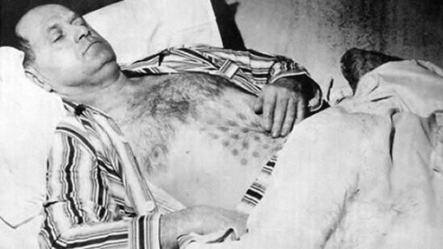 Sự cố UFO ở Hồ Falcon: Người đàn ông bị bỏng sau khi chạm vào UFO và dấu vết trên cơ thể không mờ đi suốt 32 năm!