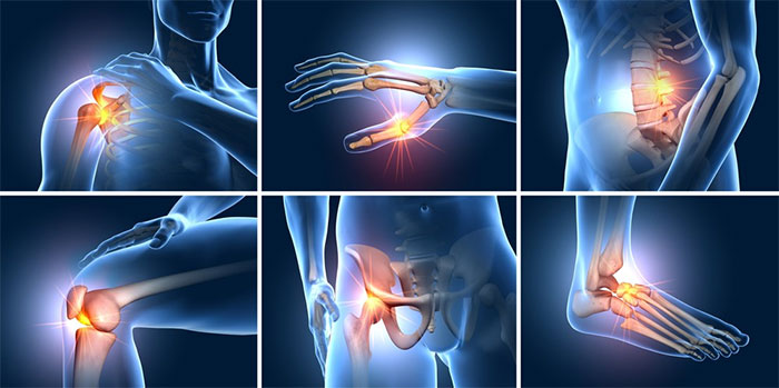 Vì sao phụ nữ mắc bệnh xương khớp cao hơn nam giới?