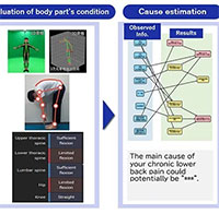 Ứng dụng AI chẩn đoán và gợi ý bài tập trị đau lưng mãn tính