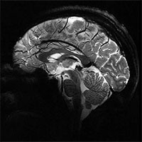 Hình ảnh rõ nét nhất về bộ não chúng ta từ siêu máy quét MRI