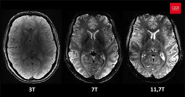 Hình ảnh rõ nét nhất về bộ não chúng ta từ siêu máy quét MRI
