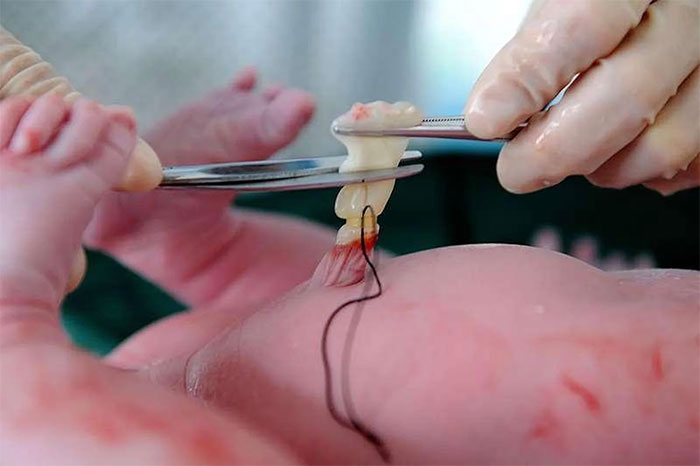 Những điều cần biết về tế bào gốc từ máu cuống rốn