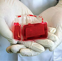 Những điều cần biết về tế bào gốc từ máu cuống rốn