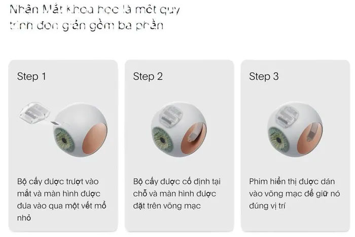 Công ty khởi nghiệp Mỹ cấy ghép mắt khoa học cho người mù