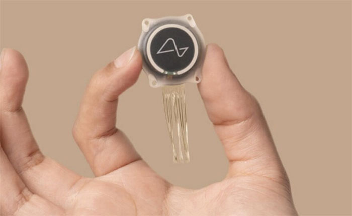 Thiết bị não-máy tính của Neuralink gặp trục trặc sau 4 tháng cấy ghép cho bệnh nhân