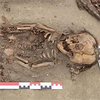 Hai ngôi mộ trẻ em hé lộ căn bệnh tàn khốc 500 năm trước
