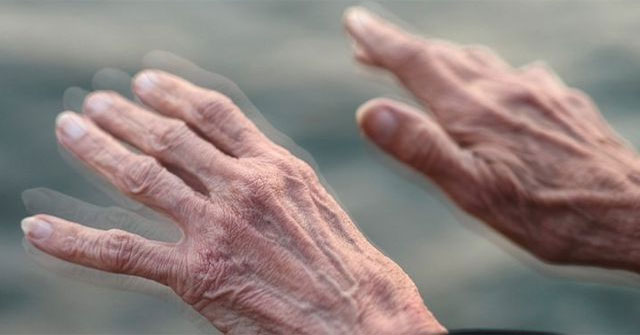 Phát triển công nghệ chẩn đoán sớm bệnh Parkinson