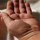 Acromegaly: Một căn bệnh hiếm gặp, khiến người lớn phát triển không kiểm soát được